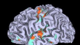Cervello, individuati i neuroni che scatenano l'ansia