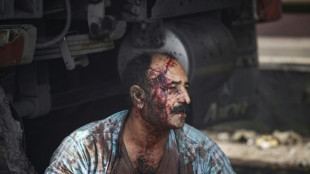 25 killed, fires still burning in huge Iran port blast