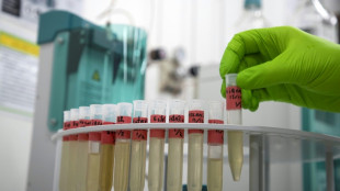 Una empresa emergente francesa apuesta por la orina para fertilizar los campos del futuro