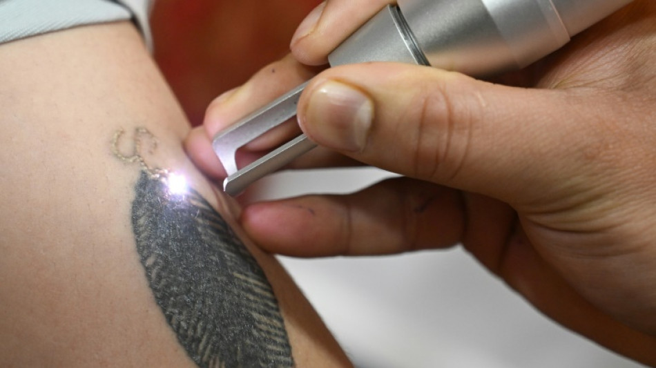 Au Cachemire indien, le nettoyage des tatouages politiques bat son plein